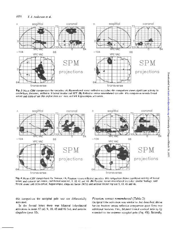 Download Cortical control of saccades and fixation in man: a PET study.